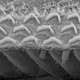 Image for article titled Promising Study Shows the Power of Gene Therapy to Treat Deafness